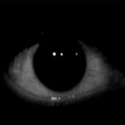 @eye_1