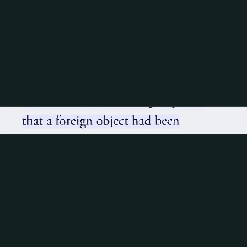 Foreign objects my dearest angel ✌️🥹🫀 by @ihatespidymite5551