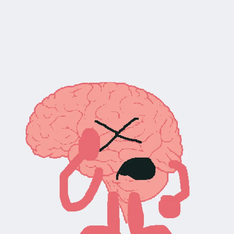 Your brain be like by @THE-PRAC-IS-BRAC