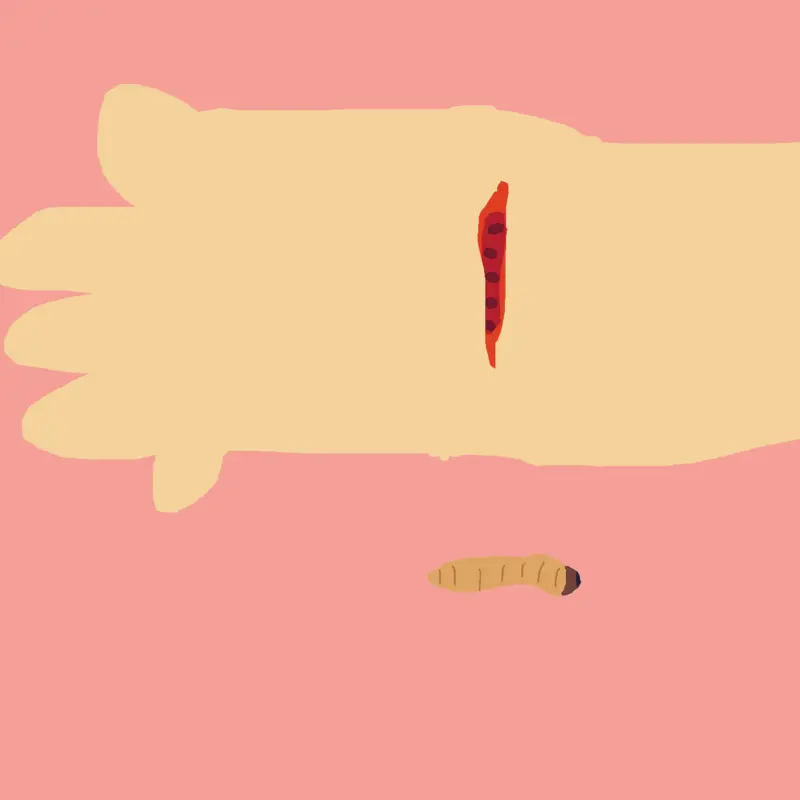 Worms. Mealworms, under your skin. by @magnet_mann