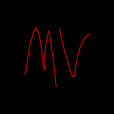 @MVloper